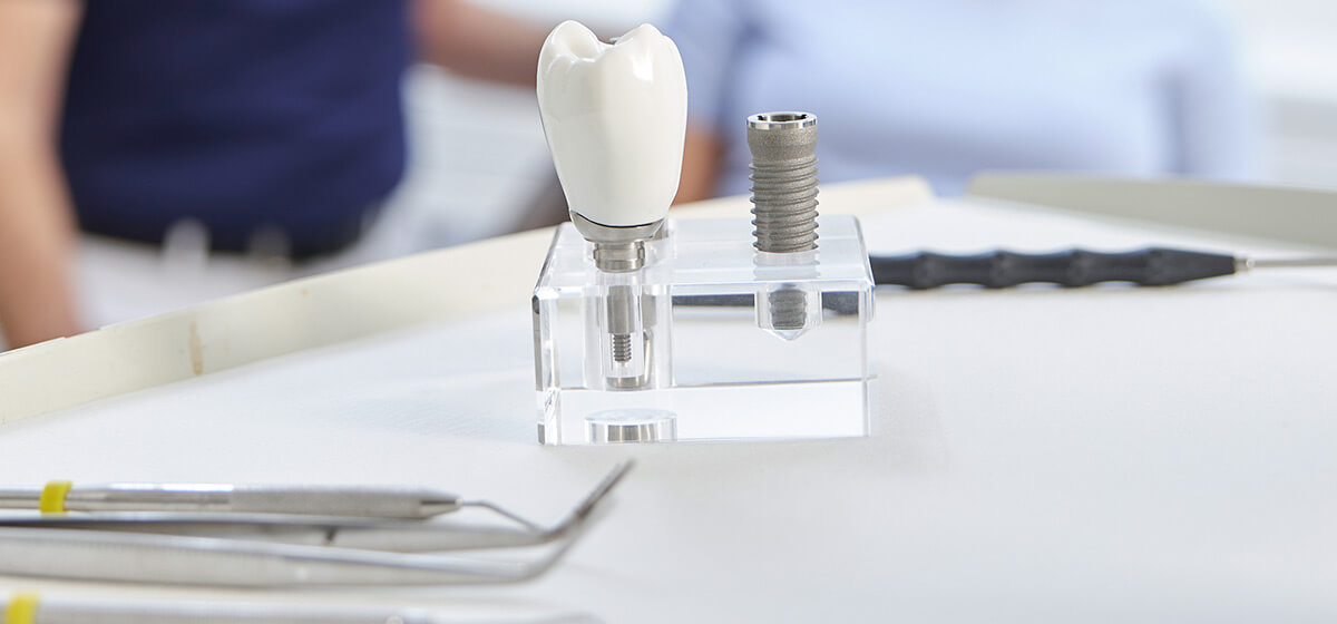Implantat-Modelle im Vordergrund, im Hintergrund Zahnarzt mit Patientin 